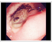 sec4_image